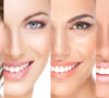 Smile Like A Celebrity 5 Tips For Whiter Teeth