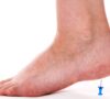 8 Questions About Peripheral Neuropathy